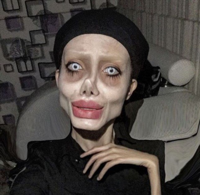 Woman Who Made Herself Look Like Angelina Jolie Gets Infected With Coronavirus