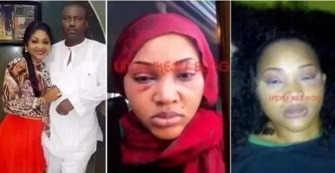 Mercy Aigbe Finally Sets The Record Straight, Releases Pictures of Her Battered Face