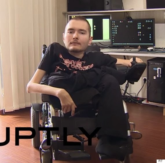 Valery Spiridonov wants to face head transplant despite warnings
