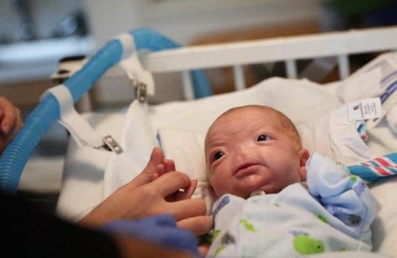 Baby born without a nose in Alabama - and the parents don't want surgery