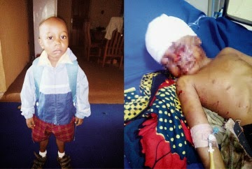 7yr old narrates how 2 dogs attacked his 4yr old brother for over an hour